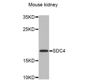 Western blot - SDC4 antibody from Signalway Antibody (38308) - Antibodies.com