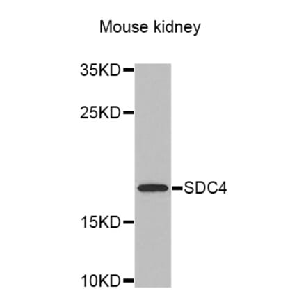 Western blot - SDC4 antibody from Signalway Antibody (38308) - Antibodies.com