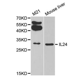 Western blot - IL24 antibody from Signalway Antibody (38311) - Antibodies.com