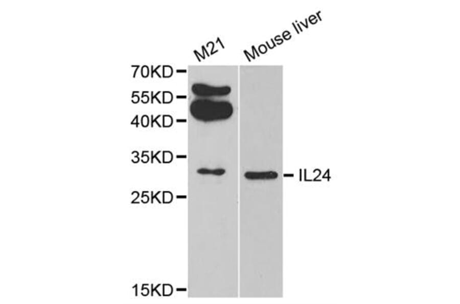 Western blot - IL24 antibody from Signalway Antibody (38311) - Antibodies.com
