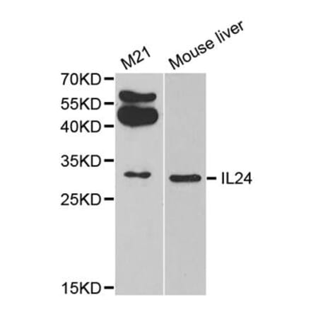 Western blot - IL24 antibody from Signalway Antibody (38311) - Antibodies.com