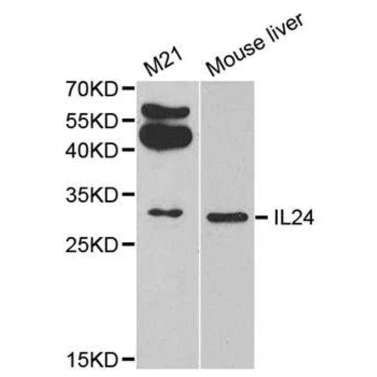 Western blot - IL24 antibody from Signalway Antibody (38311) - Antibodies.com