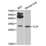 Western blot - IL24 antibody from Signalway Antibody (38311) - Antibodies.com