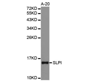 Western blot - SLPI antibody from Signalway Antibody (38316) - Antibodies.com