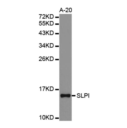 Western blot - SLPI antibody from Signalway Antibody (38316) - Antibodies.com