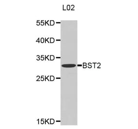 Western blot - BST2 antibody from Signalway Antibody (38318) - Antibodies.com