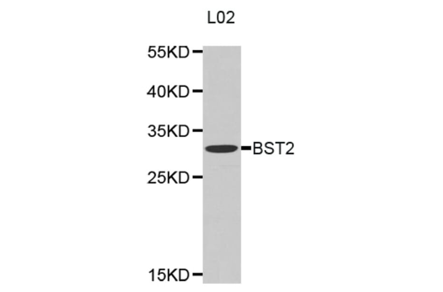 Western blot - BST2 antibody from Signalway Antibody (38318) - Antibodies.com
