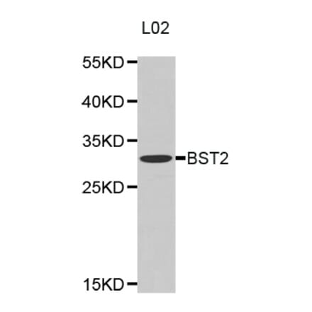 Western blot - BST2 antibody from Signalway Antibody (38318) - Antibodies.com