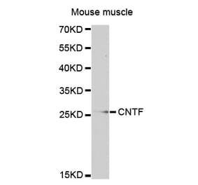 Western blot - CNTF antibody from Signalway Antibody (38319) - Antibodies.com
