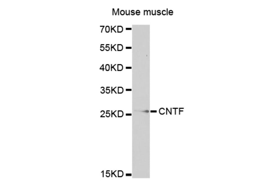 Western blot - CNTF antibody from Signalway Antibody (38319) - Antibodies.com