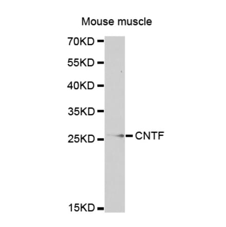 Western blot - CNTF antibody from Signalway Antibody (38319) - Antibodies.com