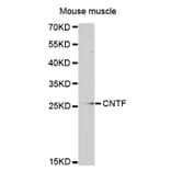 Western blot - CNTF antibody from Signalway Antibody (38319) - Antibodies.com