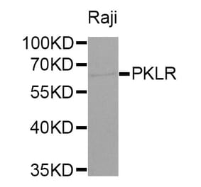 Western blot - PKLR antibody from Signalway Antibody (38320) - Antibodies.com