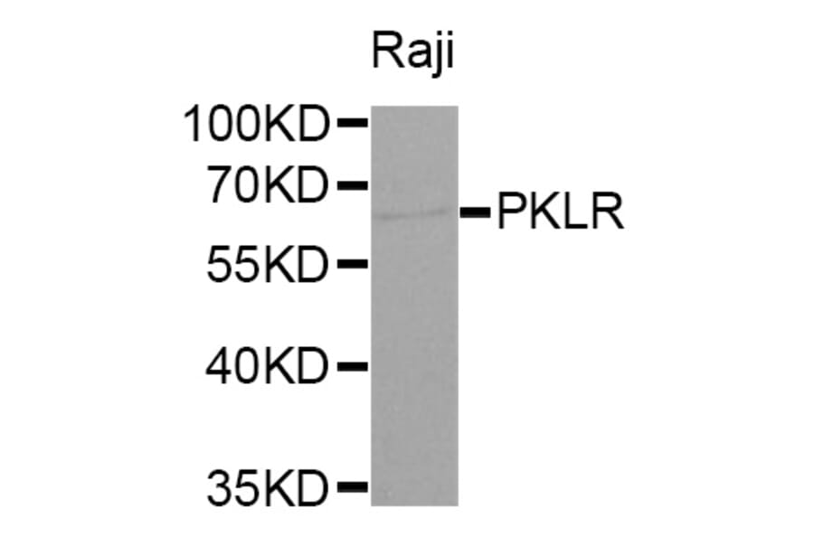 Western blot - PKLR antibody from Signalway Antibody (38320) - Antibodies.com