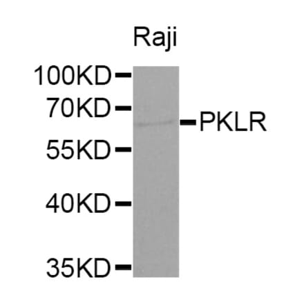Western blot - PKLR antibody from Signalway Antibody (38320) - Antibodies.com