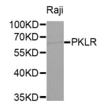 Western blot - PKLR antibody from Signalway Antibody (38320) - Antibodies.com