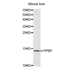 Western blot - PPBP antibody from Signalway Antibody (38321) - Antibodies.com