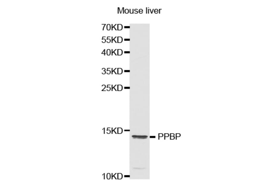Western blot - PPBP antibody from Signalway Antibody (38321) - Antibodies.com