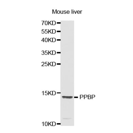Western blot - PPBP antibody from Signalway Antibody (38321) - Antibodies.com