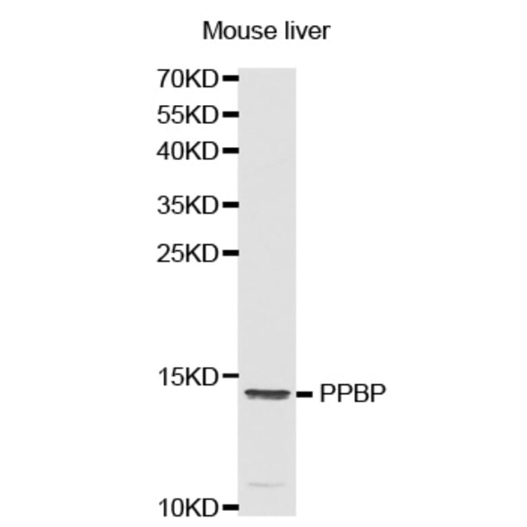 Western blot - PPBP antibody from Signalway Antibody (38321) - Antibodies.com