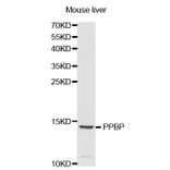 Western blot - PPBP antibody from Signalway Antibody (38321) - Antibodies.com