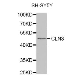 Western blot - CLN3 antibody from Signalway Antibody (38322) - Antibodies.com