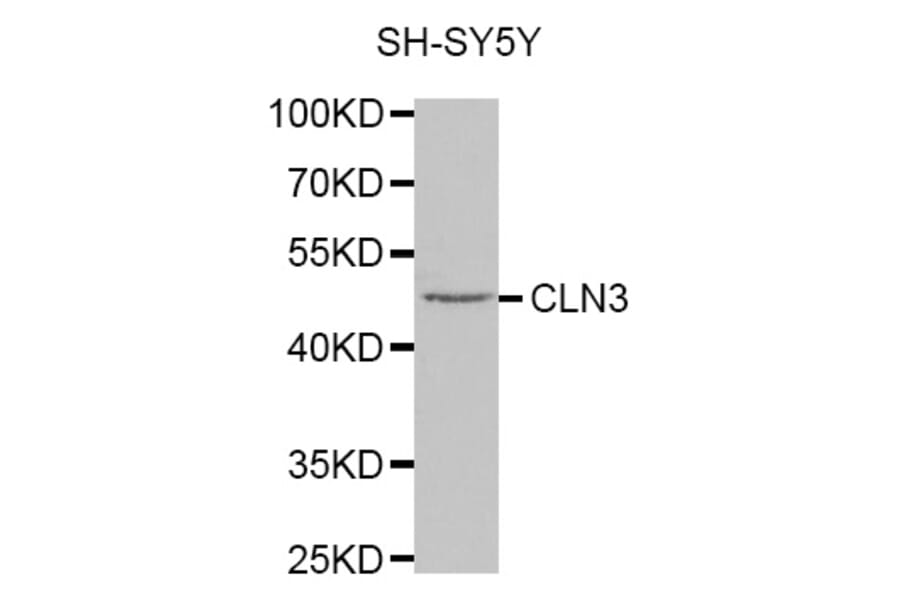 Western blot - CLN3 antibody from Signalway Antibody (38322) - Antibodies.com