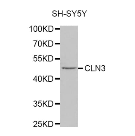 Western blot - CLN3 antibody from Signalway Antibody (38322) - Antibodies.com