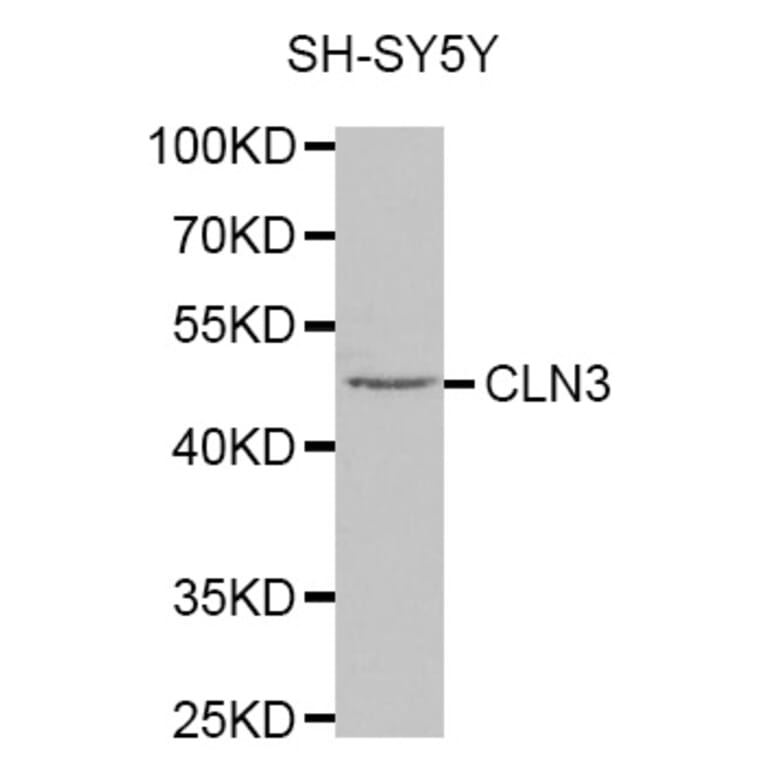 Western blot - CLN3 antibody from Signalway Antibody (38322) - Antibodies.com