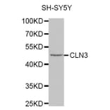 Western blot - CLN3 antibody from Signalway Antibody (38322) - Antibodies.com