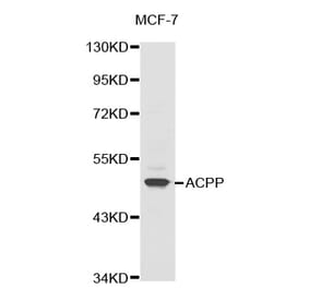 Western blot - ACPP antibody from Signalway Antibody (38324) - Antibodies.com