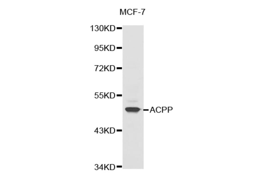 Western blot - ACPP antibody from Signalway Antibody (38324) - Antibodies.com