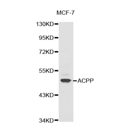 Western blot - ACPP antibody from Signalway Antibody (38324) - Antibodies.com