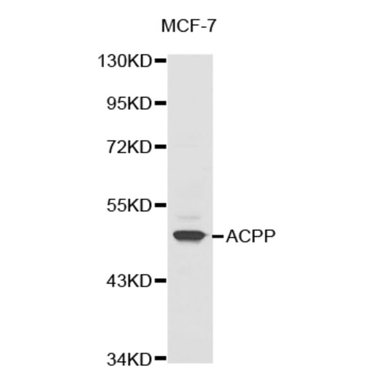 Western blot - ACPP antibody from Signalway Antibody (38324) - Antibodies.com