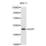 Western blot - ACPP antibody from Signalway Antibody (38324) - Antibodies.com