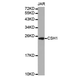 Western blot - CSH1 antibody from Signalway Antibody (38328) - Antibodies.com