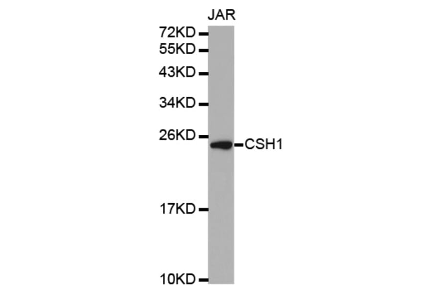 Western blot - CSH1 antibody from Signalway Antibody (38328) - Antibodies.com