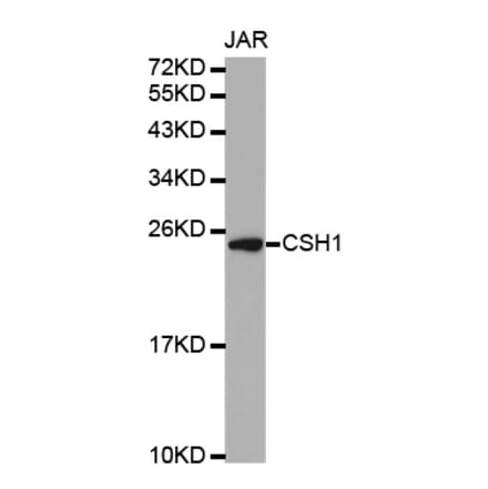 Western blot - CSH1 antibody from Signalway Antibody (38328) - Antibodies.com