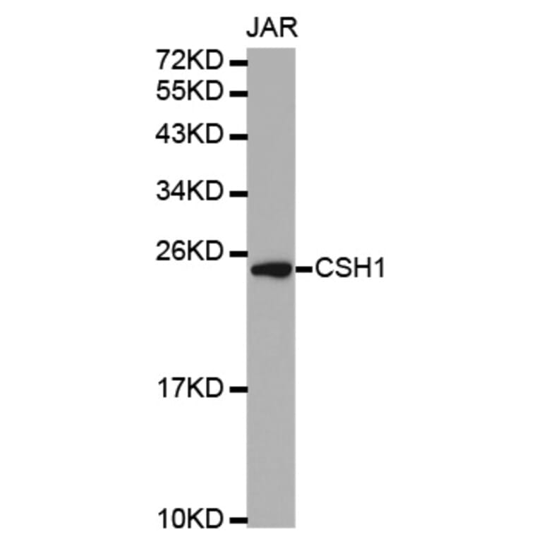 Western blot - CSH1 antibody from Signalway Antibody (38328) - Antibodies.com