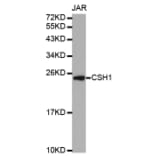 Western blot - CSH1 antibody from Signalway Antibody (38328) - Antibodies.com