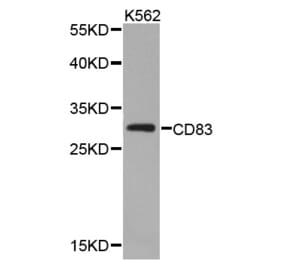 Western blot - CD83 antibody from Signalway Antibody (38339) - Antibodies.com
