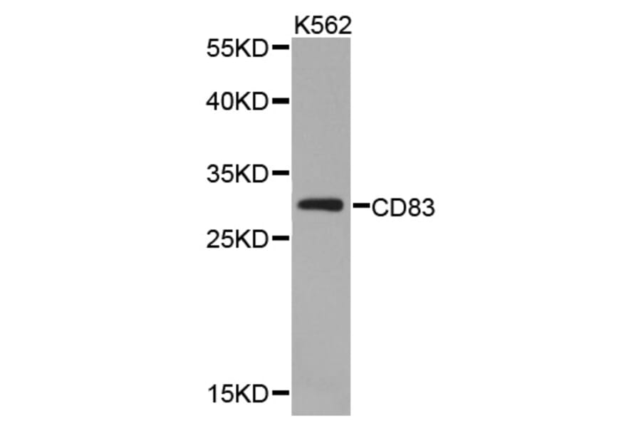 Western blot - CD83 antibody from Signalway Antibody (38339) - Antibodies.com