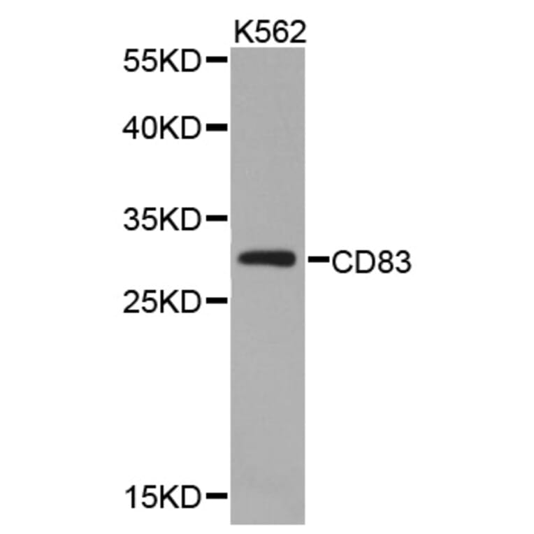 Western blot - CD83 antibody from Signalway Antibody (38339) - Antibodies.com