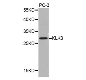 Western blot - KLK3 antibody from Signalway Antibody (38346) - Antibodies.com