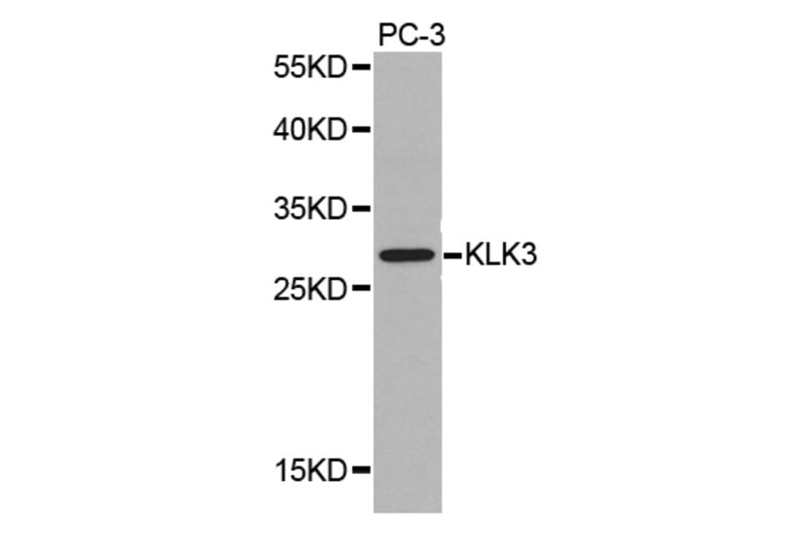 Western blot - KLK3 antibody from Signalway Antibody (38346) - Antibodies.com