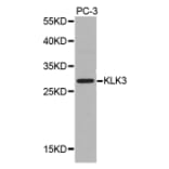 Western blot - KLK3 antibody from Signalway Antibody (38346) - Antibodies.com