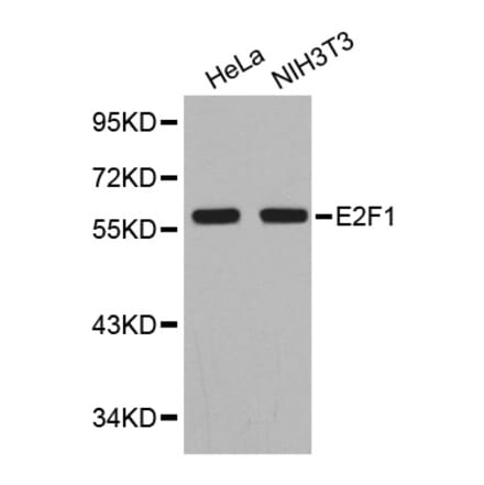 Western blot - E2F1 antibody from Signalway Antibody (38351) - Antibodies.com