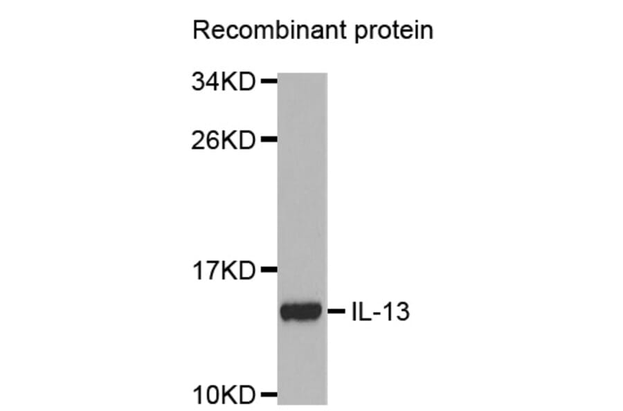 Western blot - IL13 antibody from Signalway Antibody (38354) - Antibodies.com