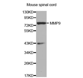 Western blot - MMP9 antibody from Signalway Antibody (38359) - Antibodies.com