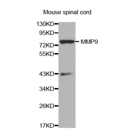 Western blot - MMP9 antibody from Signalway Antibody (38359) - Antibodies.com